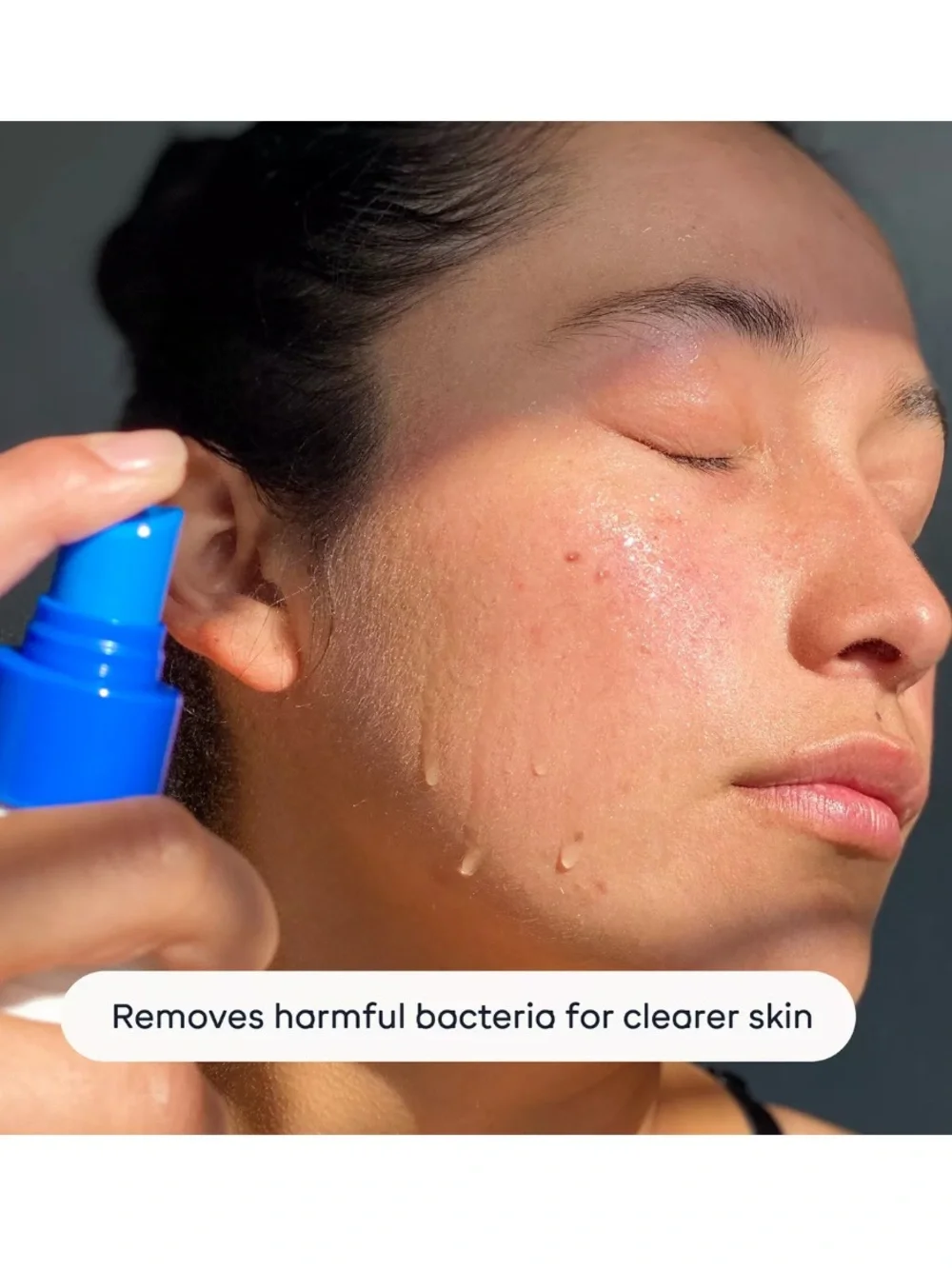 Magic Molecule Hypochlorous Acid Antimicrobial Skin Spray NEW Acne